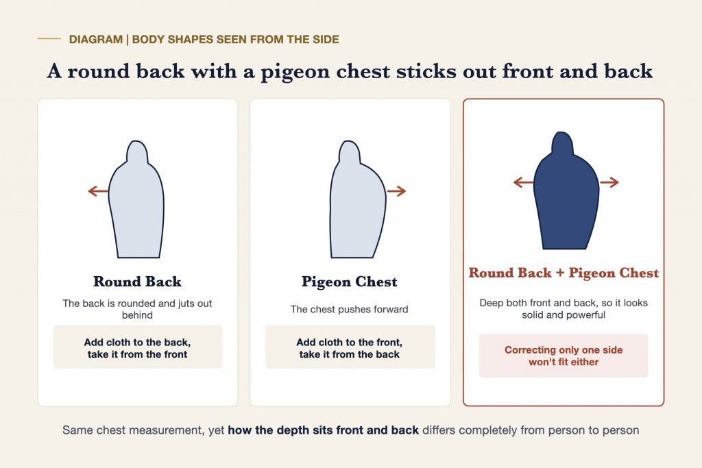 Diagram comparing a round back, a pigeon chest, and a round back with a pigeon chest, seen from the side